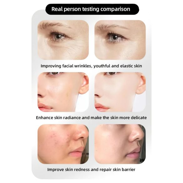 Photon Rejuvenation Ansiktspleie LED-maske