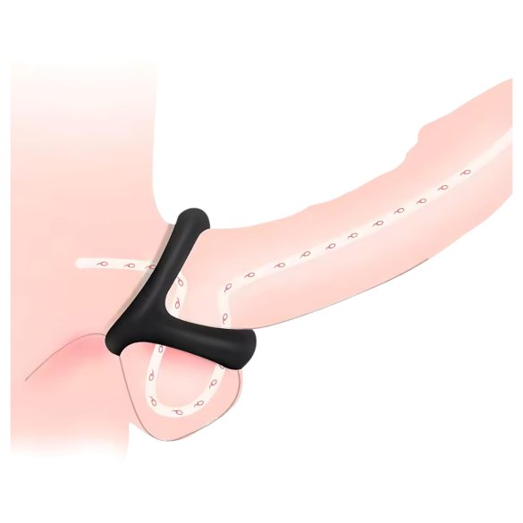 Penis- og testikkelring med prikket overflate (svart)